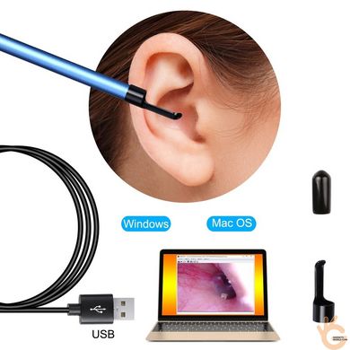 Эндоскоп медицинский ушной и зубной для ноутбука или смартфона KKMOON U-Kiss 55